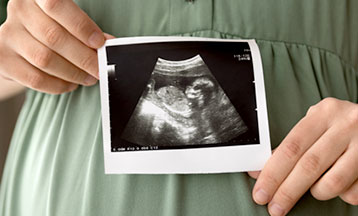 baby-dev