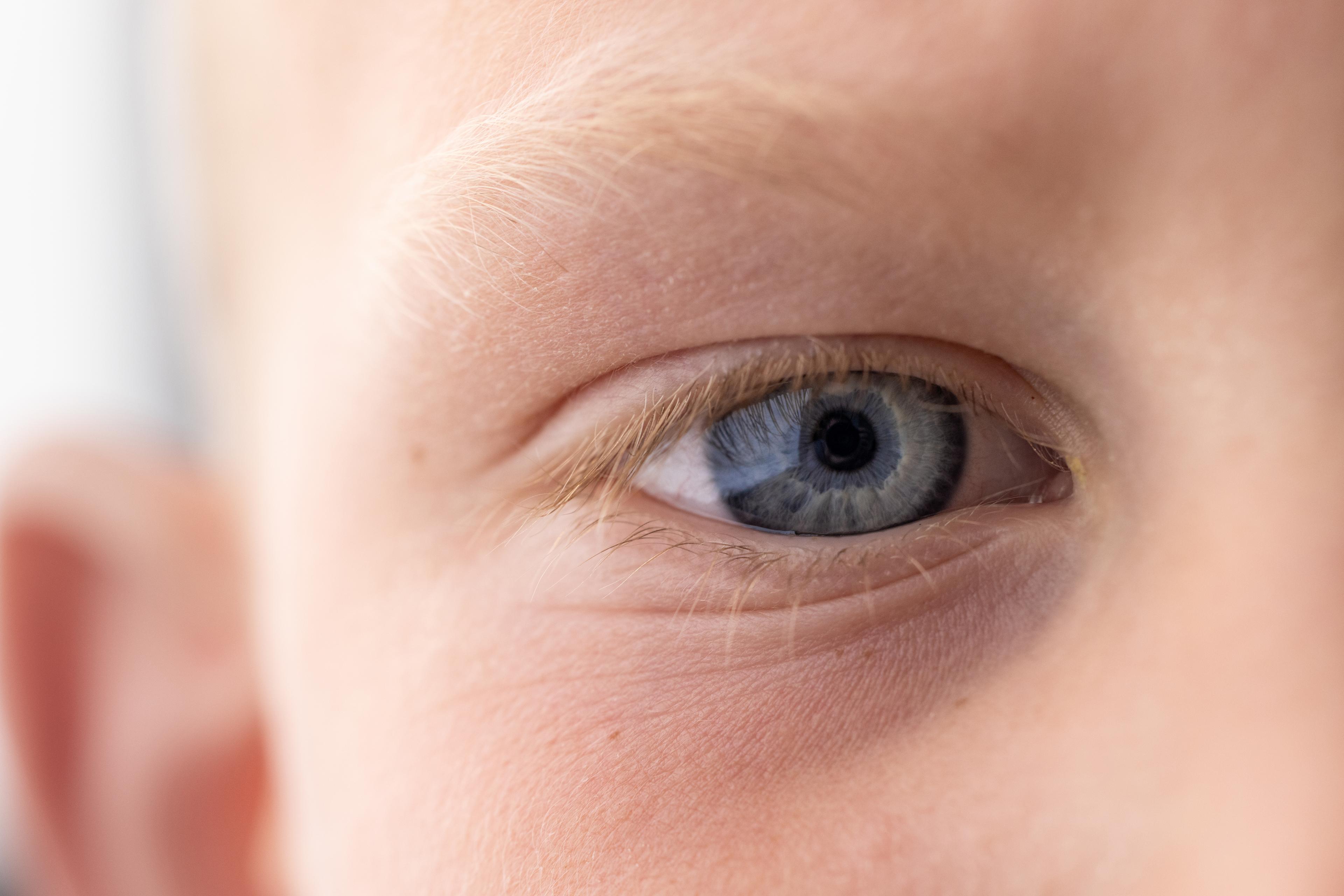 Detailed view of a child's eye showing the pupil and iris.