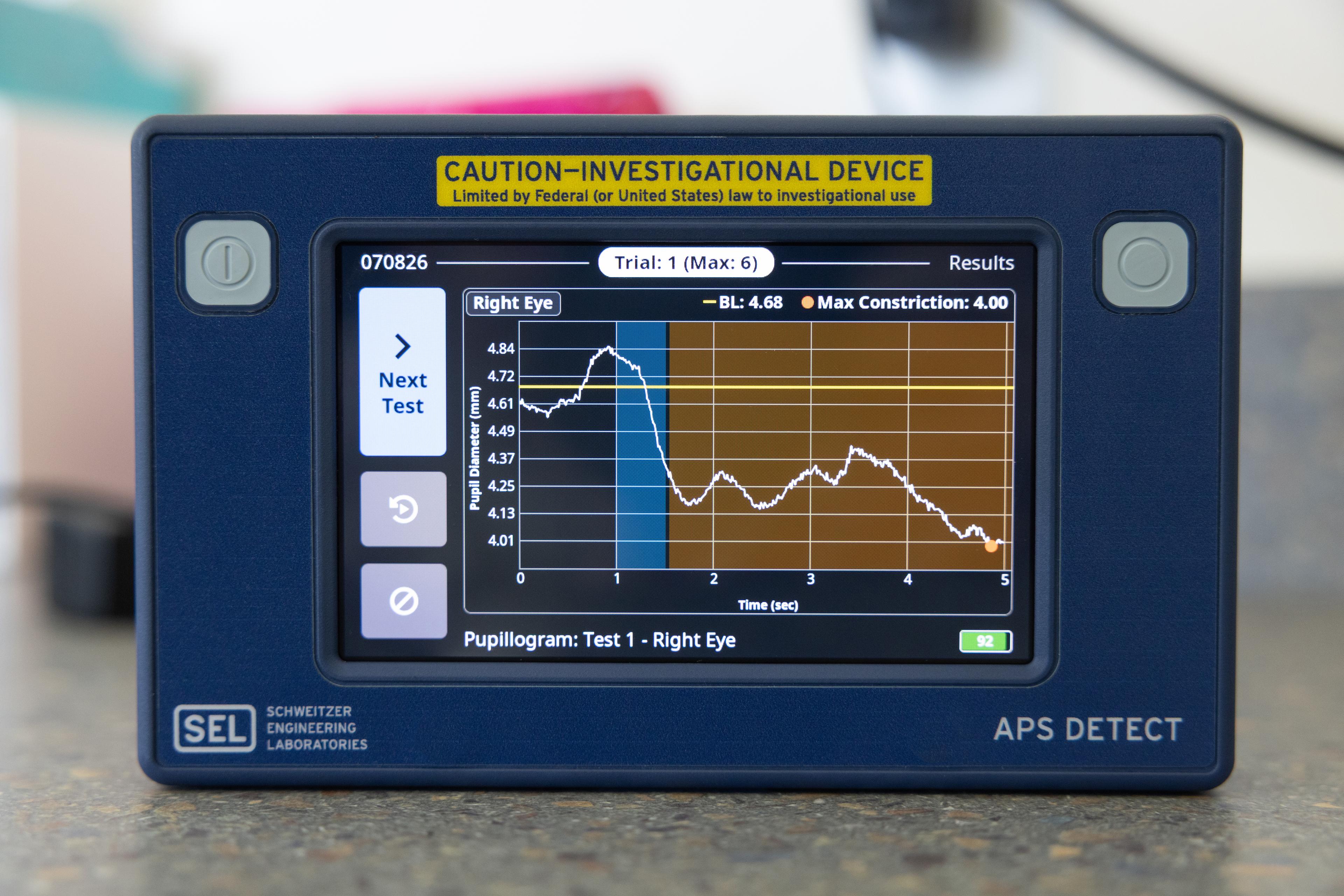 Handheld pupillometer displaying pupillary light reflex test results.