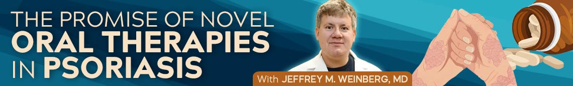The Promise of Novel Oral Therapies in Psoriasis
