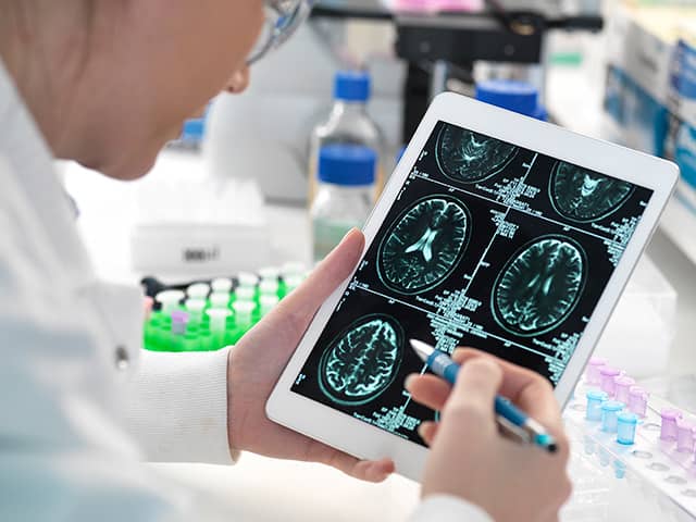 Researcher reviewing brain MRI scans on a tablet in a laboratory.