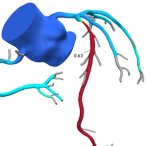 cardiact ct image of a scan