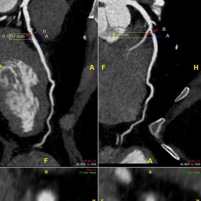 Graphic of an image that cardiologists see