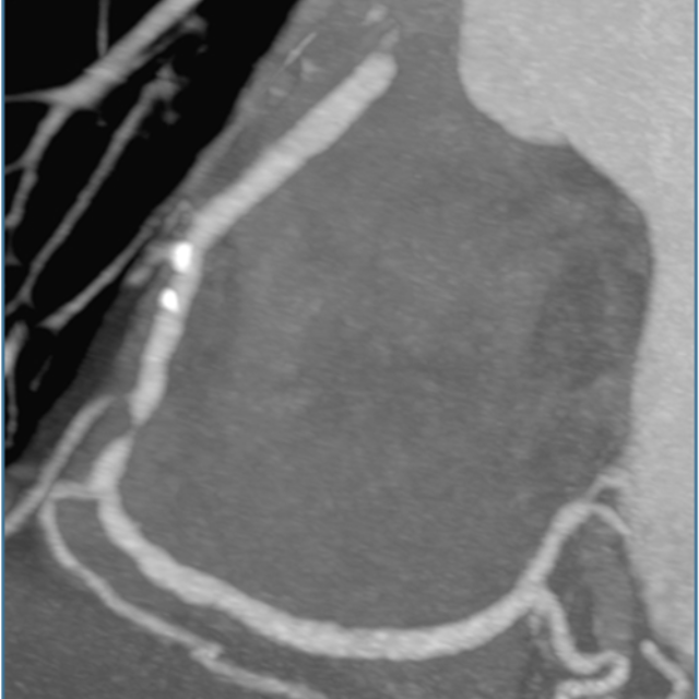 Image of something a cardiologist would see on a scan