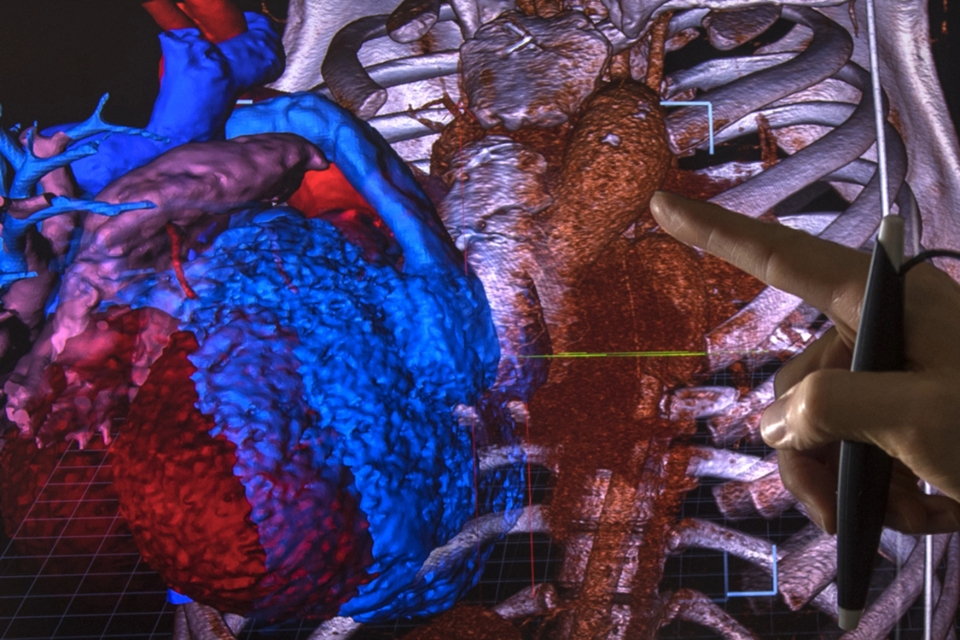 3D imaging of heart and chest cavity.