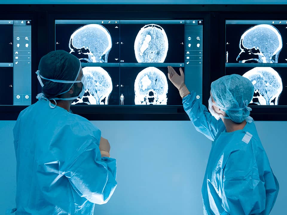 Two surgical team members review brain scan images on large medical display screens.