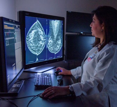 doctor looking at mammography scan