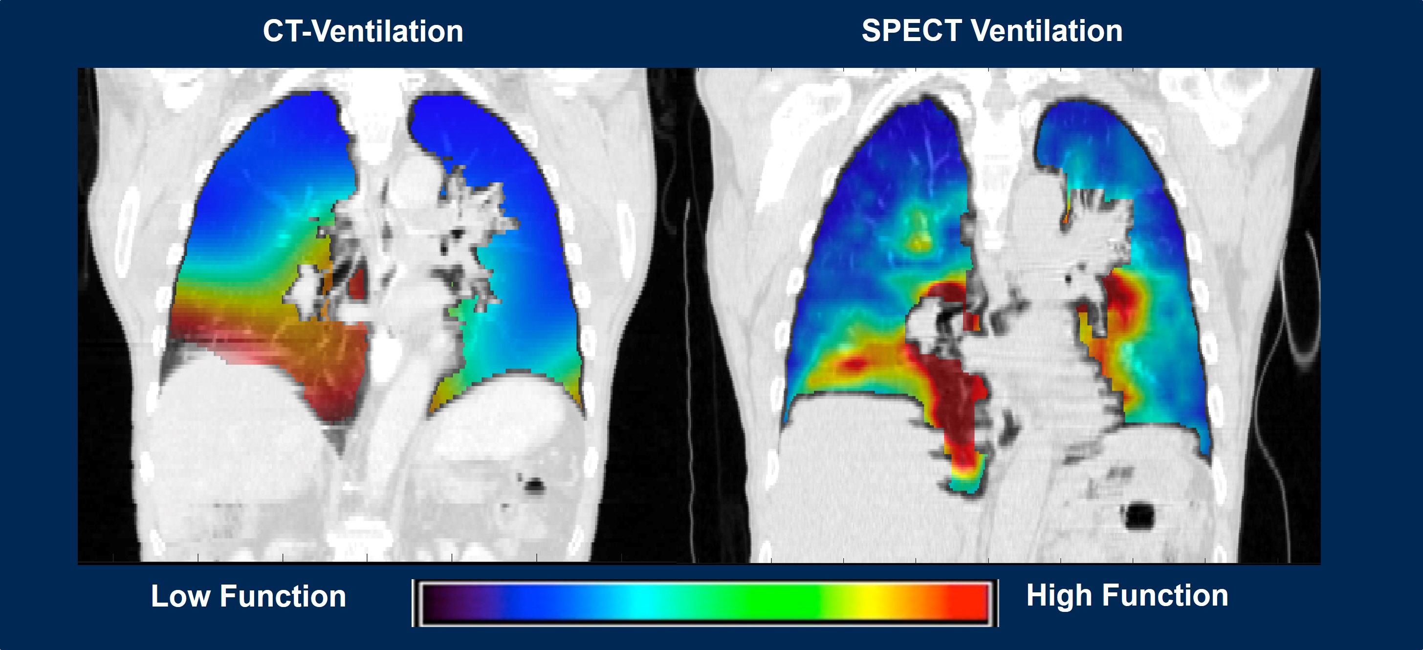 Images of a lung scan
