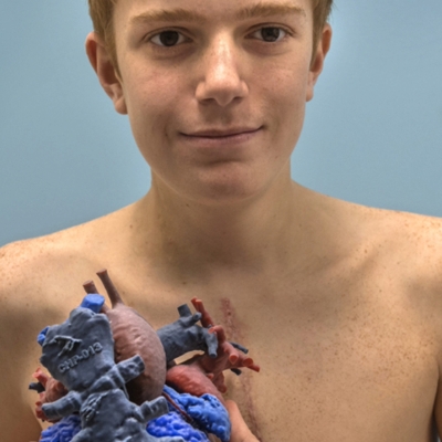 Teenage boy holding up 3D printed mockup of his heart