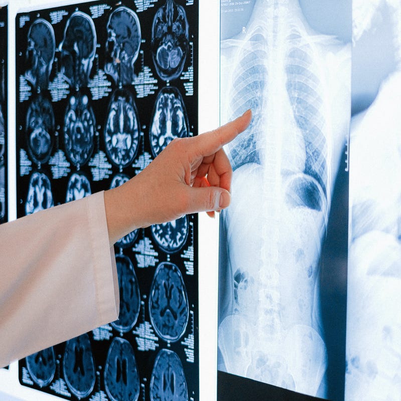 Médico indica partes do corpo humano em inglês em raio-X