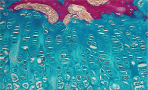 Microscopy image across a bone growth plate