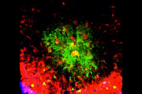Imaging showing tingible body macrophages (red) evenly dispersed to grab the dead and dying B cells (green) inside a lymph node