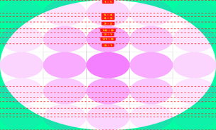 And Paradoxically, a gene variant that increases inflammation also has a protective effect on the kidneys. Seen here, kidney cell nuclei (blue) and an influx of immune regulatory cells (pink) that prevent damage in an injured kidney. (Credit: Garvan)