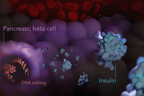 Diagram showing DNA editing of pancreatic beta cells, which produce insulin, which regulates blood-sugar levels. Credit: Kate Patterson/Garvan