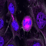 Recruiting now: study to investigate ‘sleeping' breast cancer cells