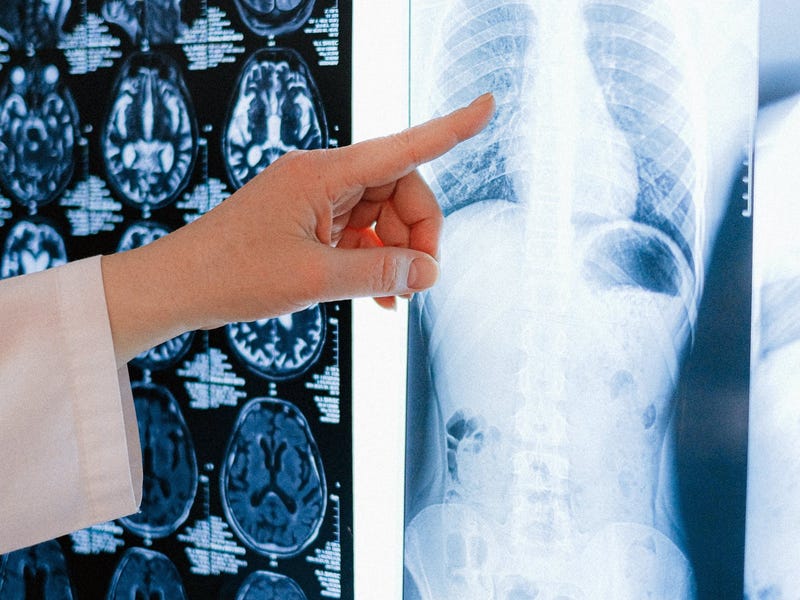 Radiografías de distintas partes del cuerpo.