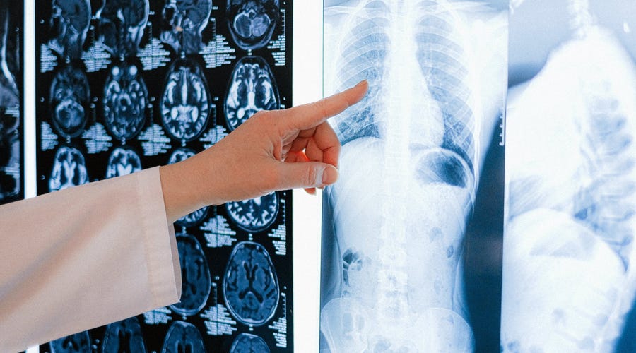 Radiografías de distintas partes del cuerpo.