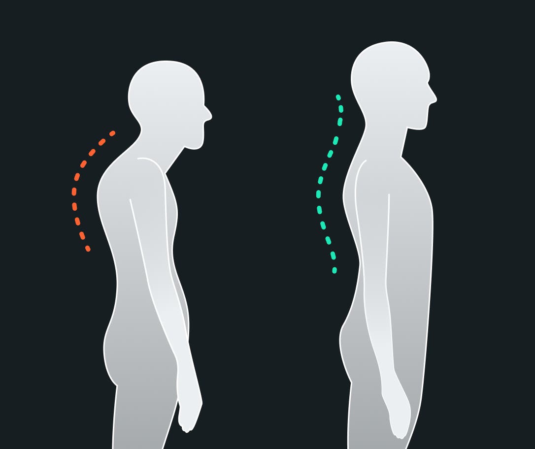 fixing-rounded-shoulders-1.jpg