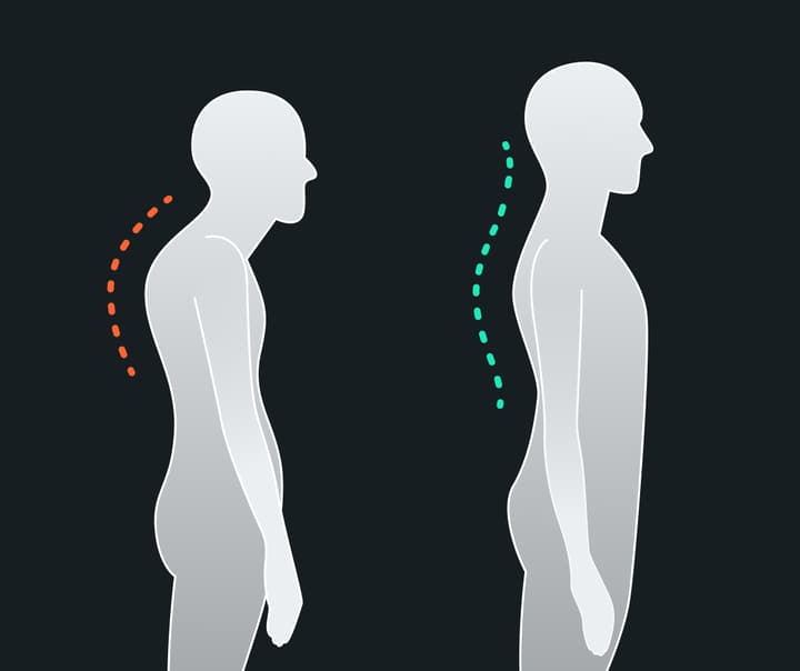 fixing-rounded-shoulders-1.jpg