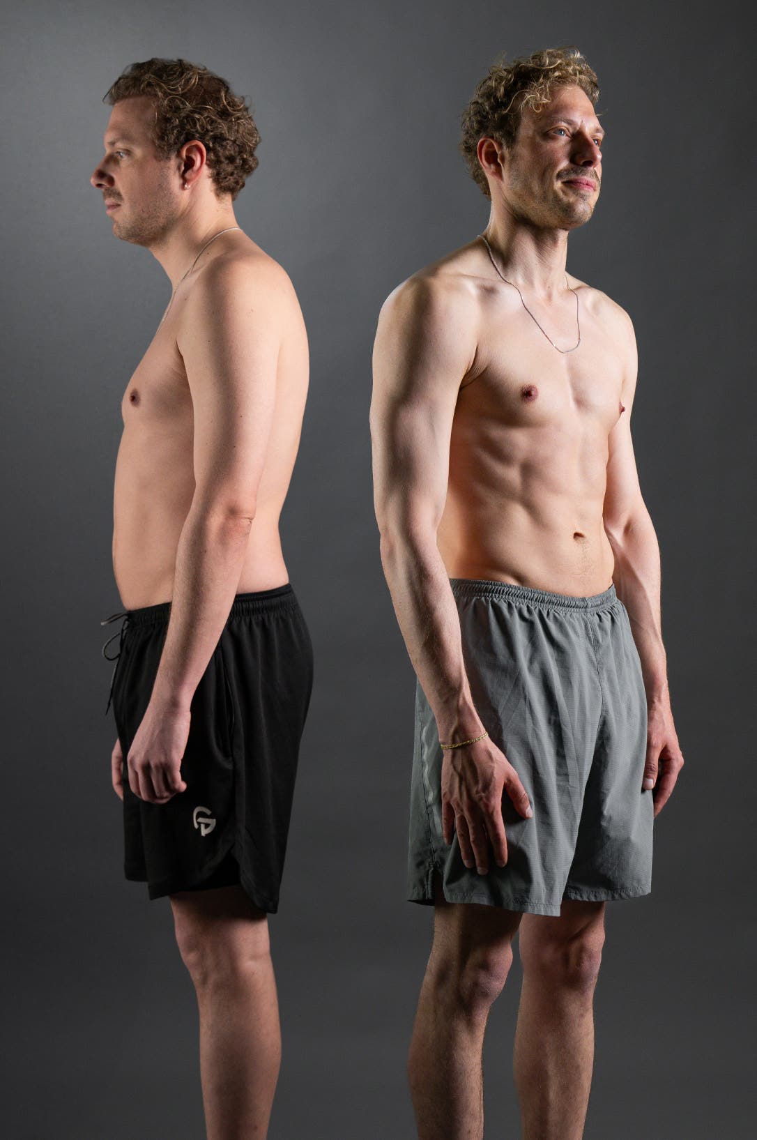 oliver-before-after-2025.jpg