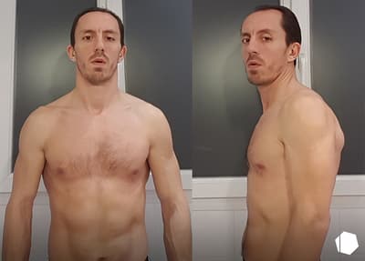 Stephane Glapski before & after