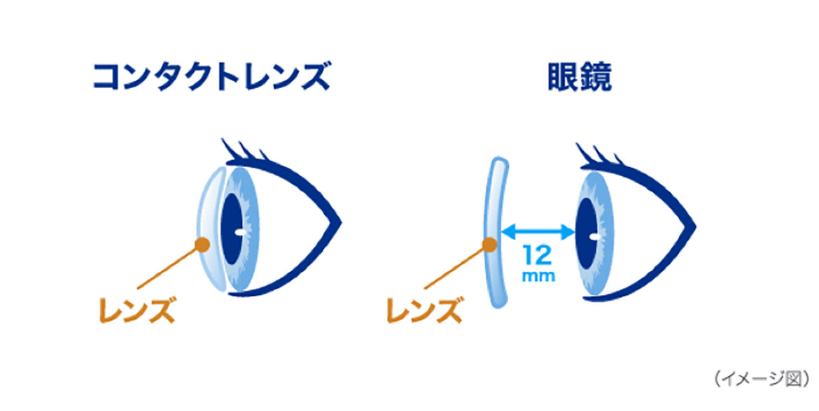 イメージ図:コンタクトレンズと眼鏡 イメージ図:コンタクトレンズと眼鏡