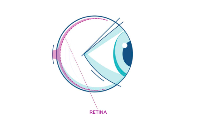 Illustrazione di un occhio che evidenzia la retina