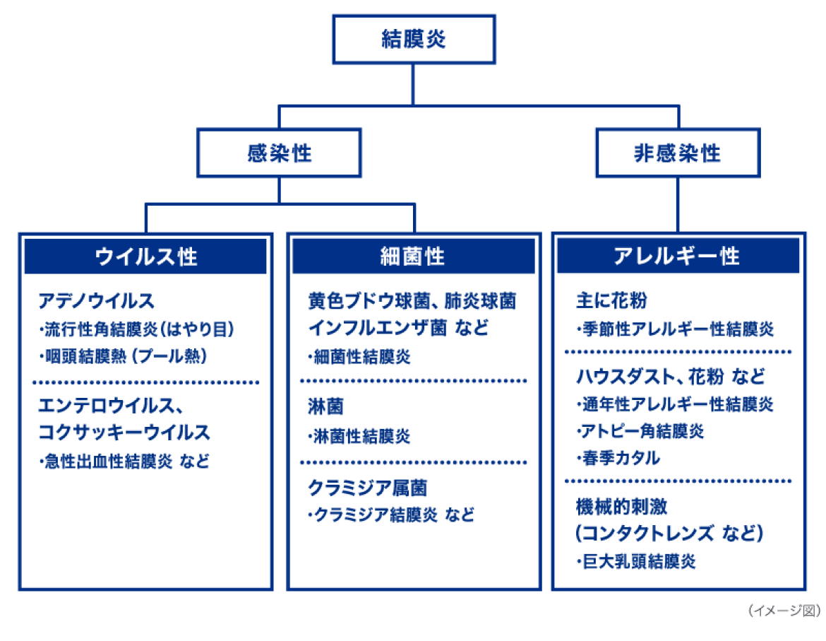 結膜炎の種類と主な症状　イメージ図