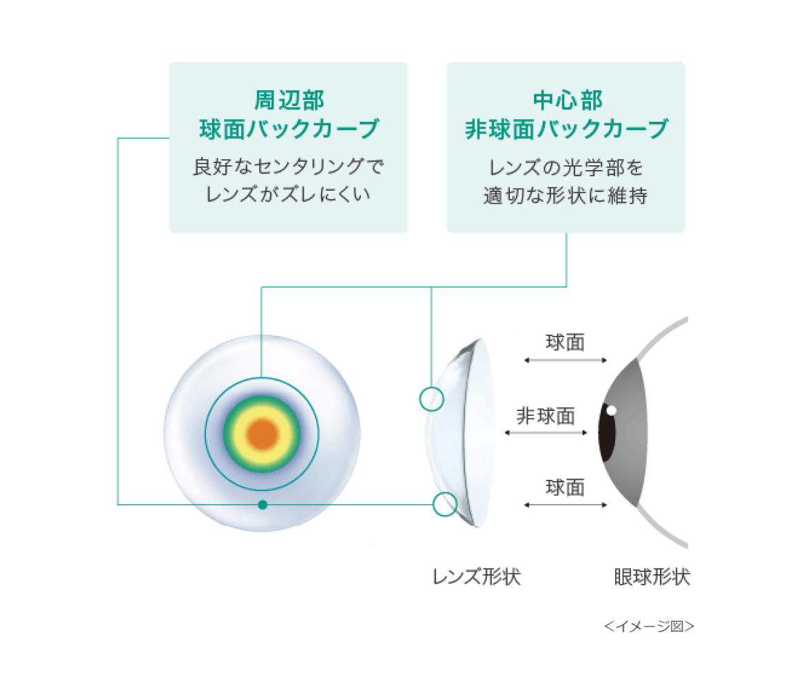 周辺部球面バックカーブ 良好なセンタリングでレンズがズレにくい　中心部非球面バックカーブ レンズの光学部を適切な形状に維持