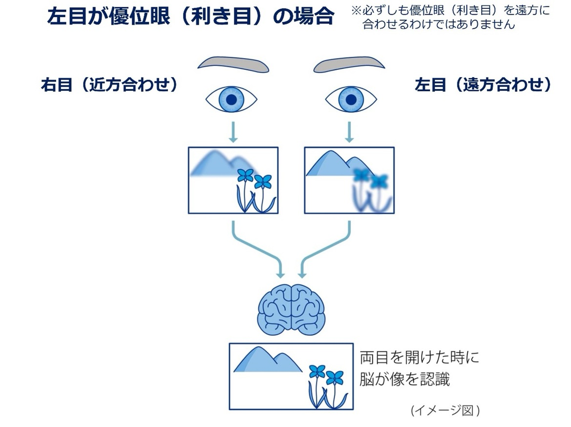 右目 左目 両目を開けたときに脳が像を認識 イメージ図