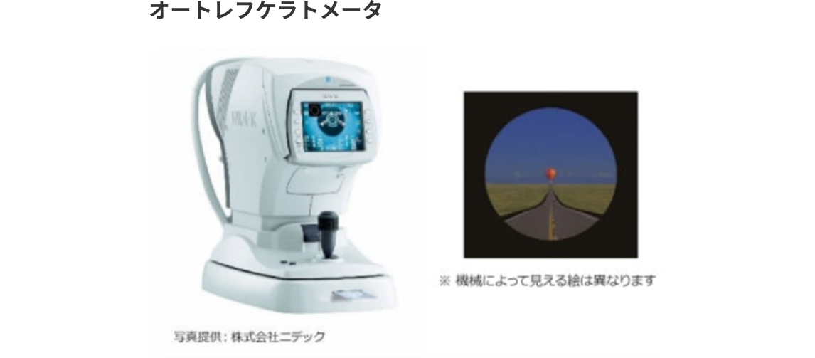 オートレフケラトメータ