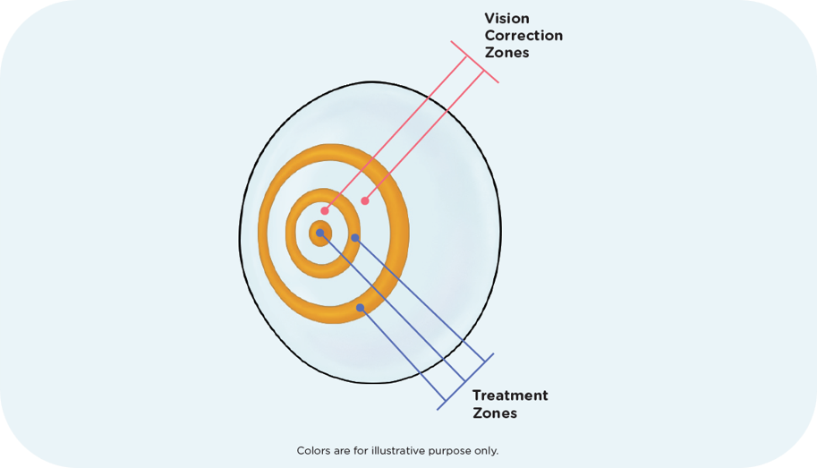 RingBoost Explanation Image RingBoost Explanation Image