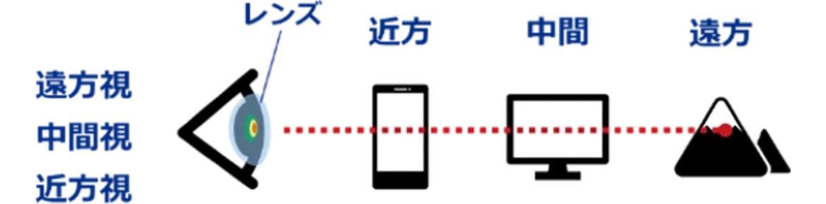 遠近両用コンタクトレンズ*（遠方から近方まで見える範囲が拡大。視線の移動は不要（同時視））