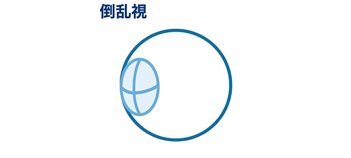 倒乱視
