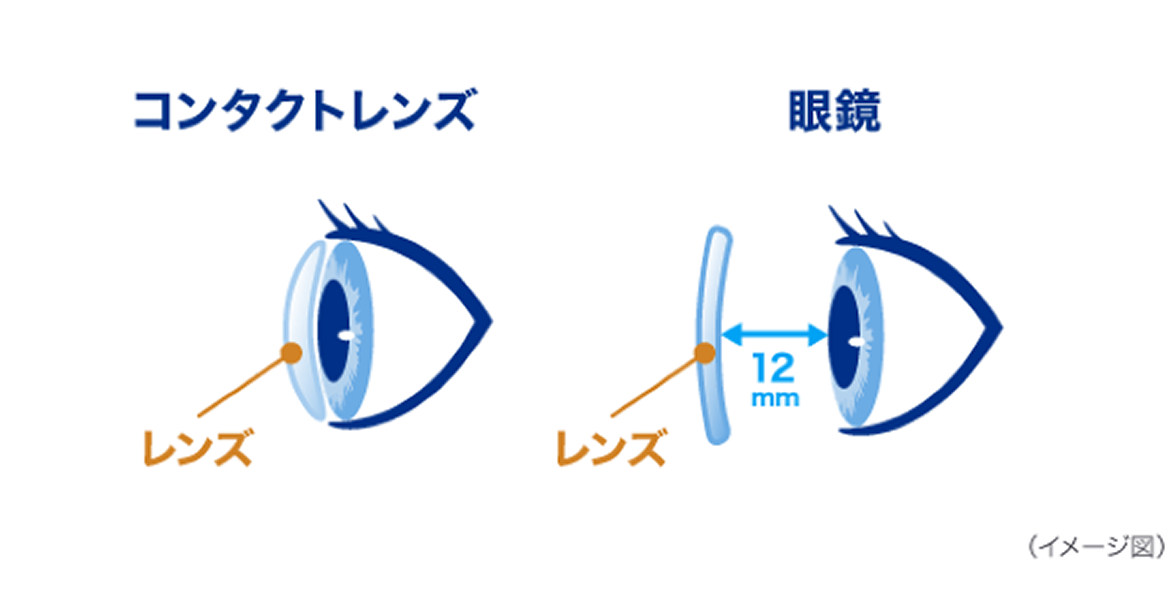 （イメージ図）コンタクトレンズと眼鏡