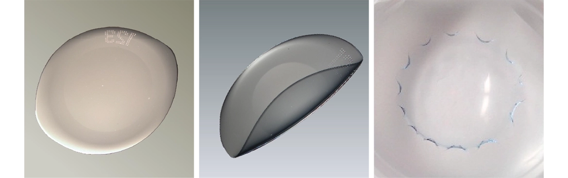 コンタクトレンズの変形・折れ・縁(ふち)の波打ち コンタクトレンズの変形・折れ・縁(ふち)の波打ち