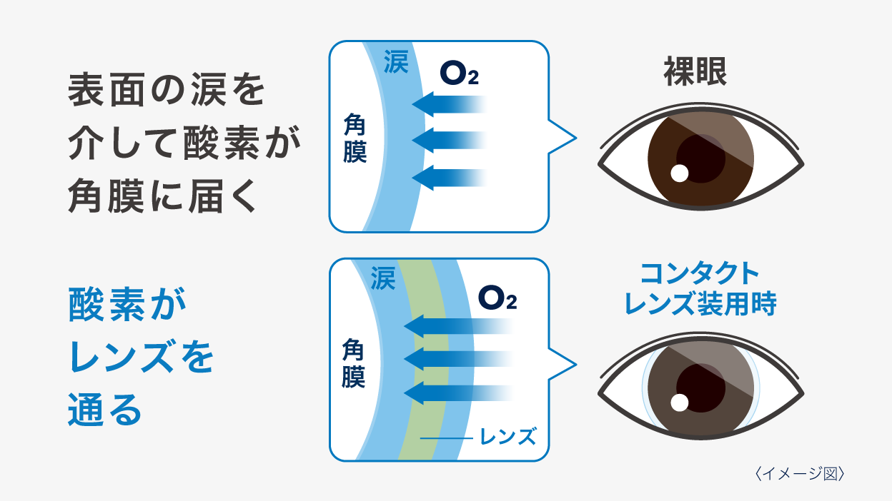 (イメージ図)裸眼:表面の涙が酸素を角膜に通す、コンタクトレンズ装用時:酸素がレンズを通る (イメージ図)裸眼:表面の涙が酸素を角膜に通す、コンタクトレンズ装用時:酸素がレンズを通る