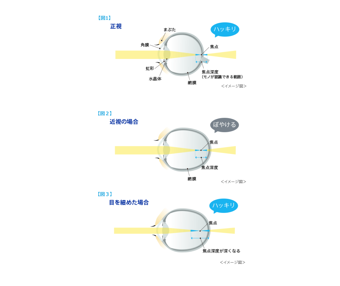 正視　近視の場合　目を覚めた場合　イメージ図