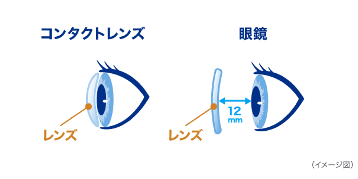 （イメージ図）コンタクトレンズと眼鏡