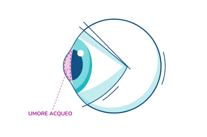 Illustrazione di un occhio che evidenzia l'umore acqueo