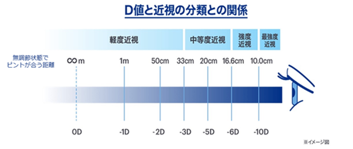 イメージ図：D値と近視の分類との関係