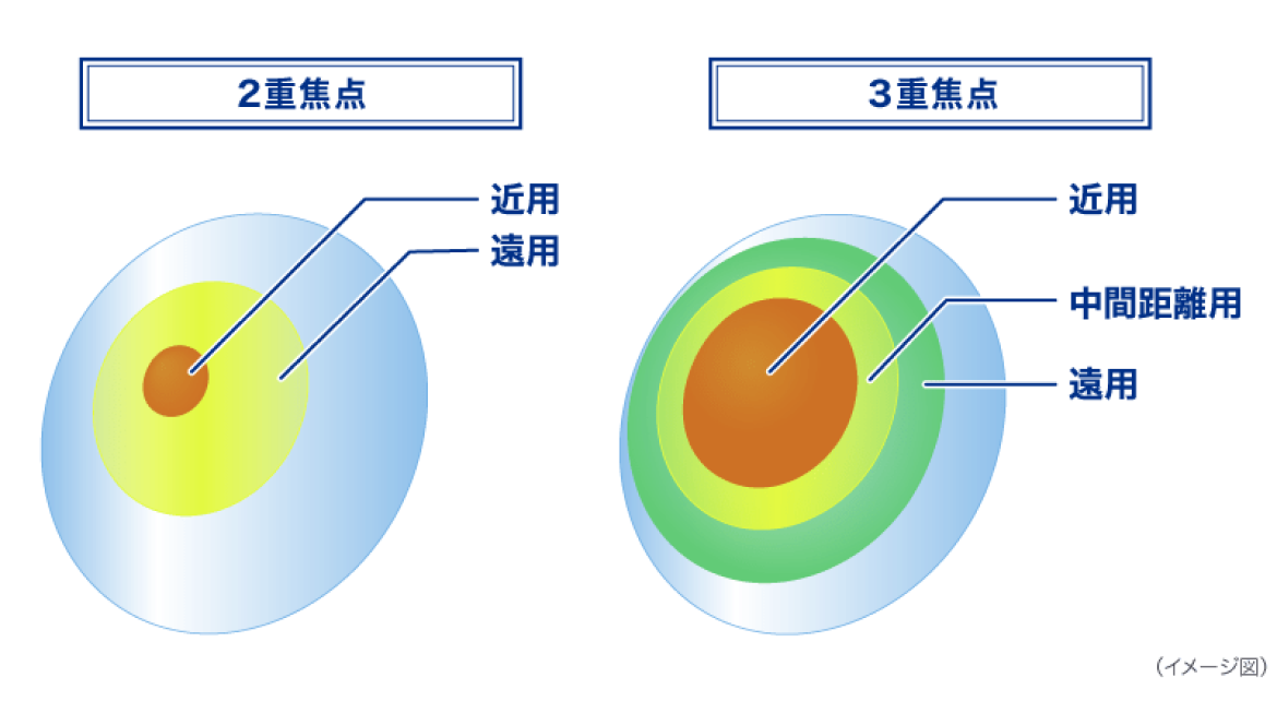 2重焦点 3重焦点