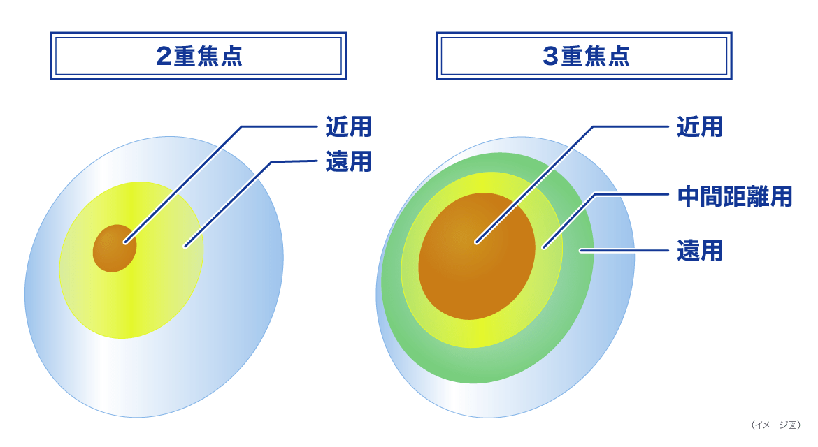 2重焦点 3重焦点