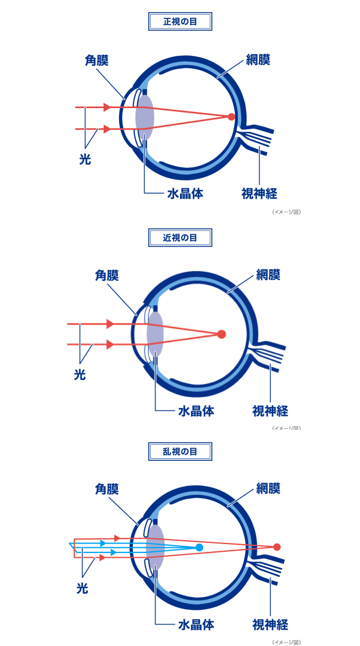 正視の目 近視の目 乱視の目