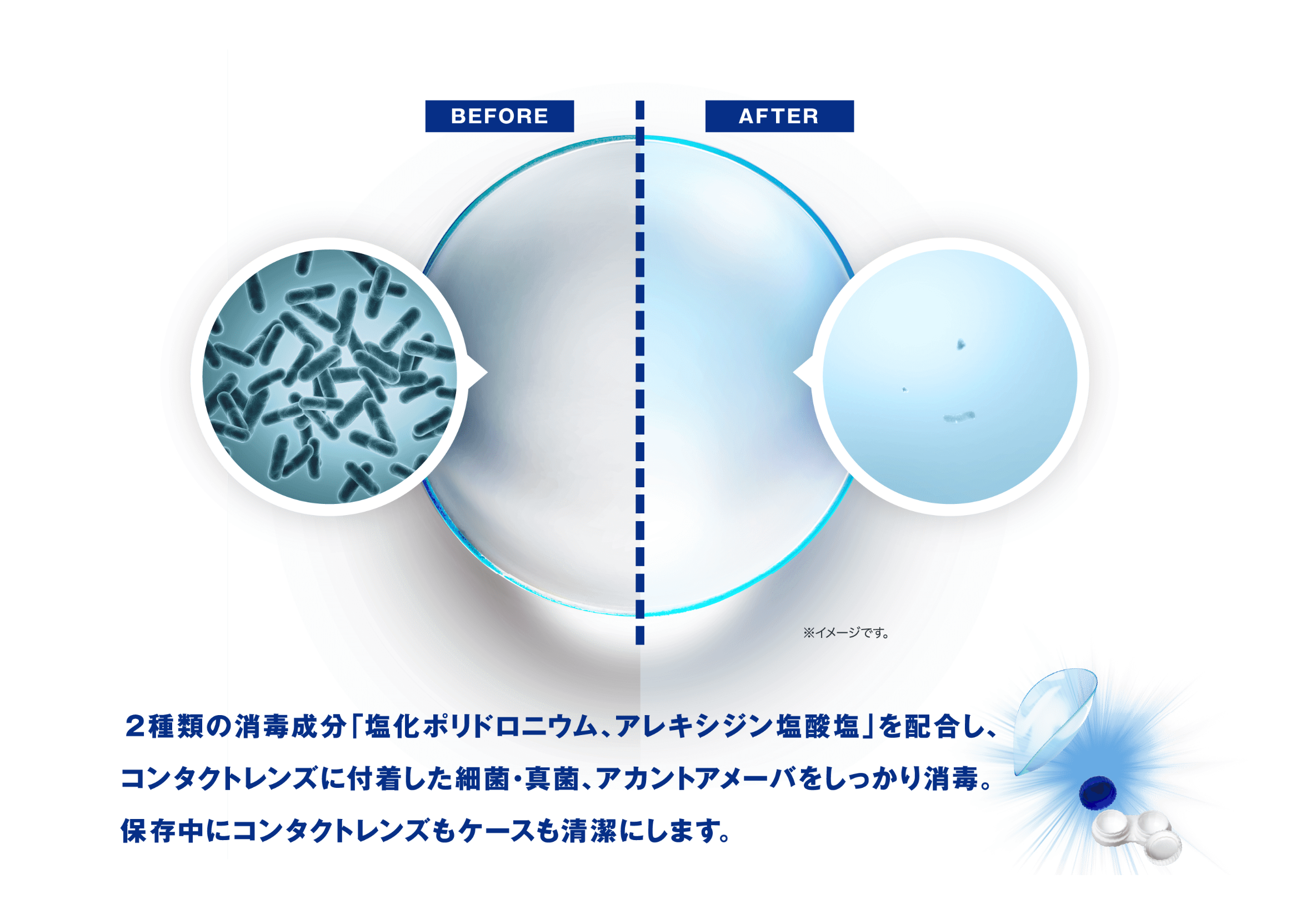 2種類の消毒成分「塩化ポリドロニウム、アレキシジン塩酸塩」を配合し、コンタクトレンズに付着した細菌・真菌、アカウントアメーバをしっかり消毒。保存中のコンタクトレンズもケースも清潔にします。