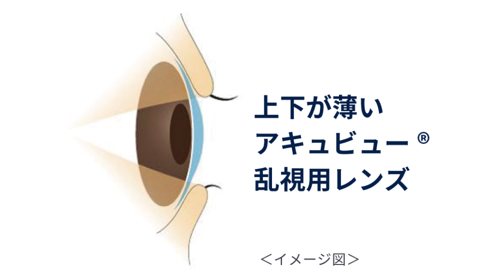  下方に厚みがある乱視用レンズ　上下が薄いアキュビュー® 乱視用レンズ