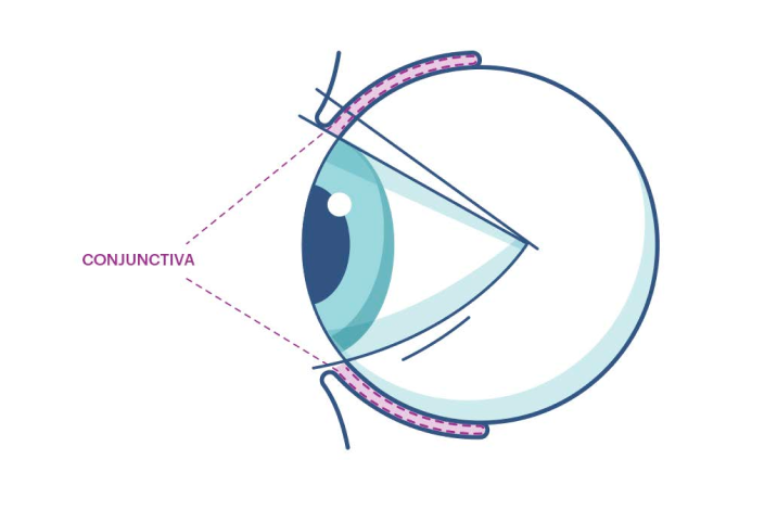 An illustration showing where the conjunctiva is in the eye.