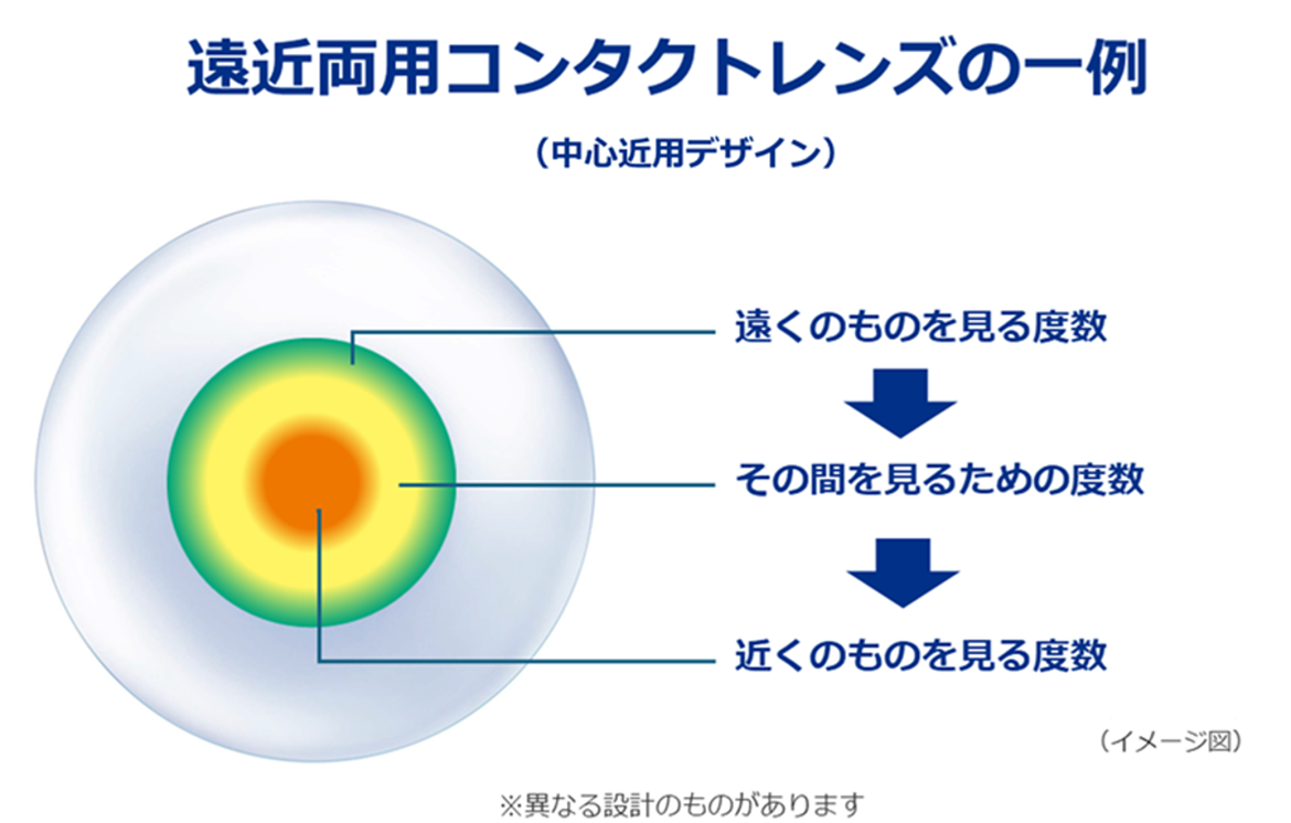 遠近コンタクトレンズの一例 遠近コンタクトレンズの一例