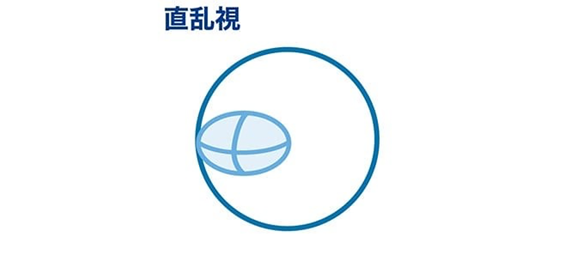 直乱視