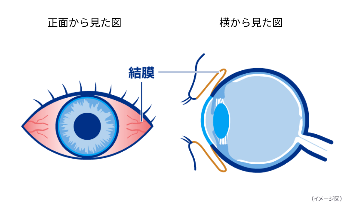 正面から見た図　横から見た図　結膜　イメージ図